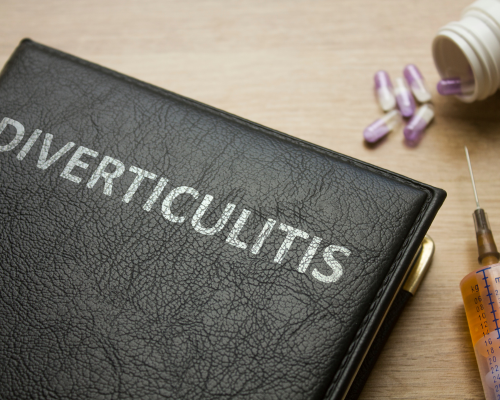 Meal Plan for Diverticulitis to Diverticulosis