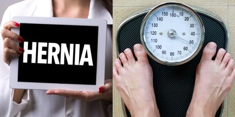 hernia sergery weight lose